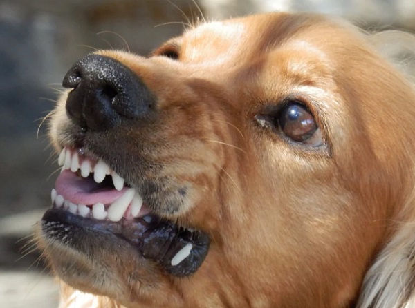 Dog Bite Injury